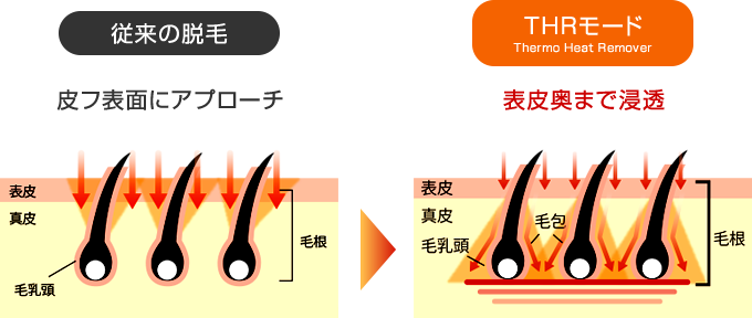 表皮奥まで浸透 THRモード