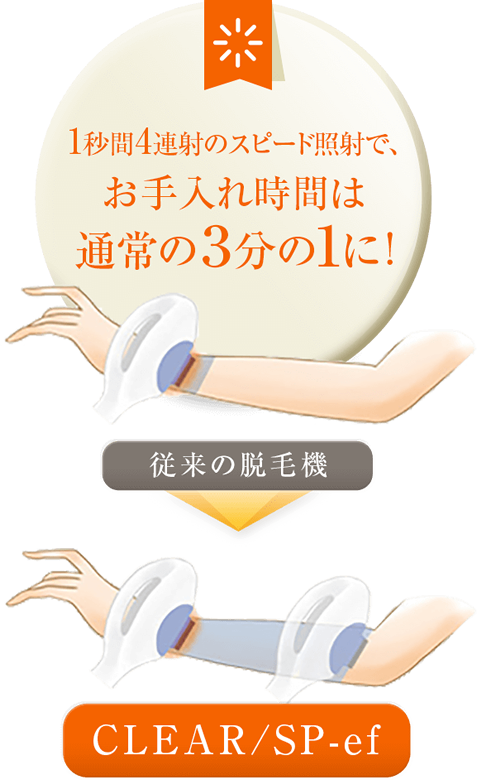 1秒間4連射のスピード照射で、お手入れ時間は通常の3分の1に!