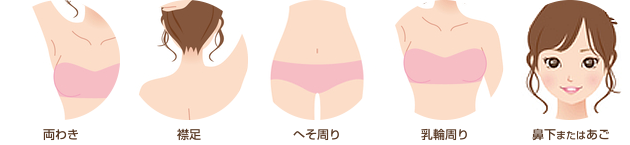 両わき 襟足 へそ周り 乳輪周り はな下orあご